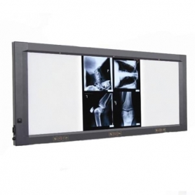 نگاتوسکوپ دیجیتالی LED چهار خانه